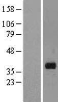 MARCHF8 Human Over-expression Lysate