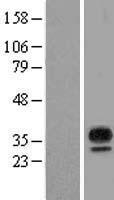 MARCHF8 Human Over-expression Lysate