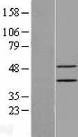 Epithelial Stromal Interaction 1 (EPSTI1) Human Over-expression Lysate
