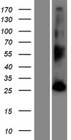 PHETA2 Human Over-expression Lysate
