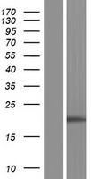 STAG3L1 Human Over-expression Lysate