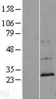 CCDC144NL Human Over-expression Lysate
