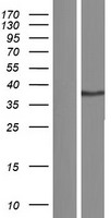CD200 Human Over-expression Lysate