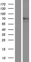 Quiescin Q6 (QSOX1) Human Over-expression Lysate