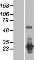 DUSP27 (DUPD1) Human Over-expression Lysate