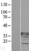 C1orf222 Human Over-expression Lysate