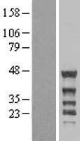 Nck beta (NCK2) Human Over-expression Lysate