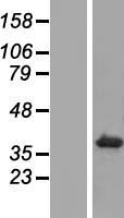 TMEM198 Human Over-expression Lysate
