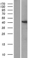 ST8SIA6 Human Over-expression Lysate