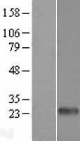 DECTIN 2 (CLEC6A) Human Over-expression Lysate