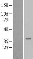 TCEAL6 Human Over-expression Lysate