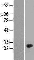 C1QL4 Human Over-expression Lysate