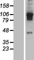 USP20 Human Over-expression Lysate