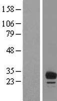 MVB12B Human Over-expression Lysate