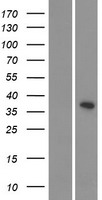 CDKL4 Human Over-expression Lysate