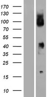 CD64 (FCGR1B) Human Over-expression Lysate