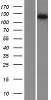 Phosphorylase B (PHKB) Human Over-expression Lysate