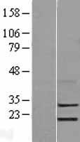 LYPD5 Human Over-expression Lysate