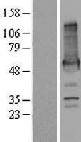 PALM2 Human Over-expression Lysate