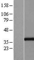 GGPS1 Human Over-expression Lysate