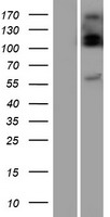 UGT2B10 Human Over-expression Lysate