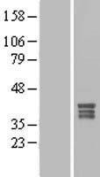 MPPED1 Human Over-expression Lysate