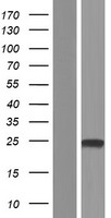 TMEM91 Human Over-expression Lysate