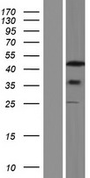 Septin 8 (SEPT8) Human Over-expression Lysate