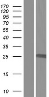 IFT43 Human Over-expression Lysate