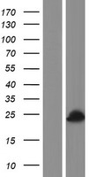 AMELY Human Over-expression Lysate