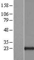 ARL 1 (ARL1) Human Over-expression Lysate