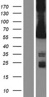 CAMK2G Human Over-expression Lysate