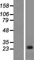 CLNS1A Human Over-expression Lysate