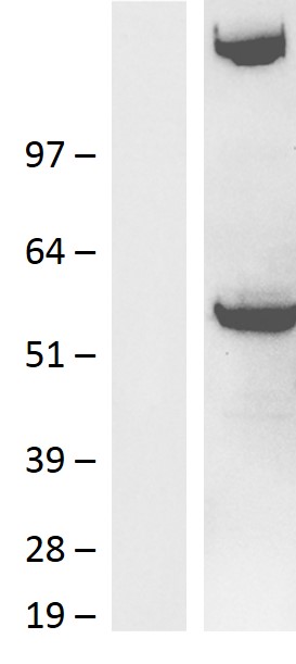 CELSR2 Human Over-expression Lysate