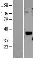CCN1 (CYR61) Human Over-expression Lysate