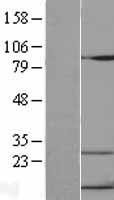 IP10 (CXCL10) Human Over-expression Lysate