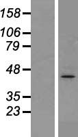 gamma Actin (ACTG1) Human Over-expression Lysate