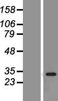 CDK2 Human Over-expression Lysate