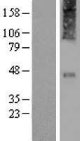 Corticotropin Releasing Factor Receptor 2 (CRHR2) Human Over-expression Lysate