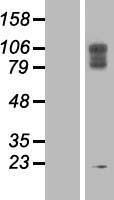 LAMP2 Human Over-expression Lysate