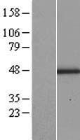 Lumican (LUM) Human Over-expression Lysate