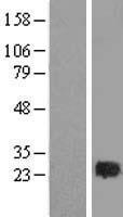 Rab2 (RAB2A) Human Over-expression Lysate