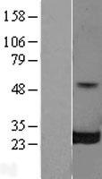 RALB Human Over-expression Lysate