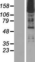 SMRC2 (SMARCC2) Human Over-expression Lysate