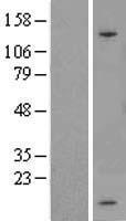 SPINK1 Human Over-expression Lysate
