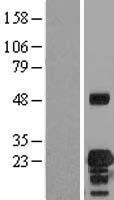 VEGFB Human Over-expression Lysate