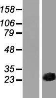 CSRP3 Human Over-expression Lysate