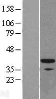 FKBP6 Human Over-expression Lysate