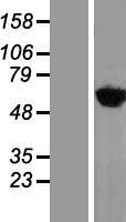 Tyrosyl tRNA synthetase (YARS) Human Over-expression Lysate