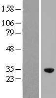 RFXANK Human Over-expression Lysate